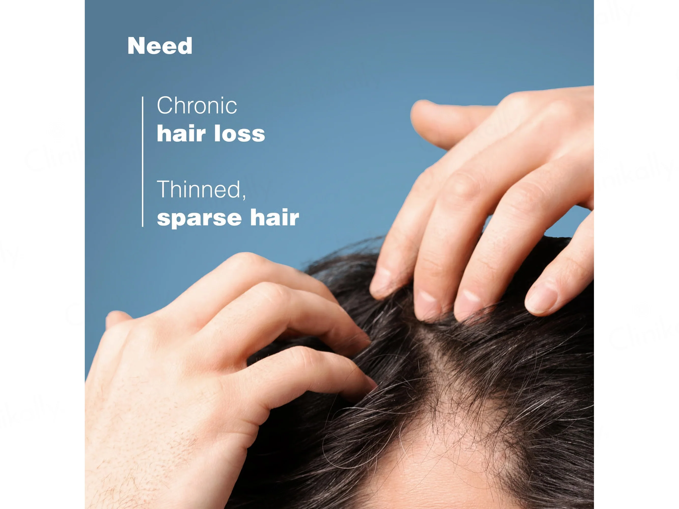 Ducray Anaphase Anti-Hair Loss Anti-Thinning Shampoo - Image 9